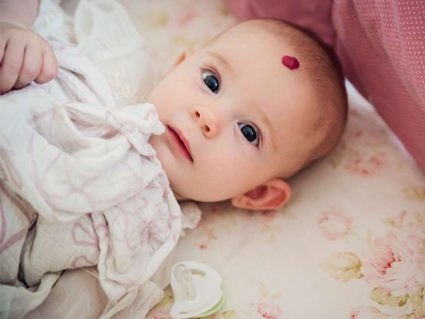 Doğum Lekesi Neden Olur? Doğum Lekesi Nasıl Geçer?